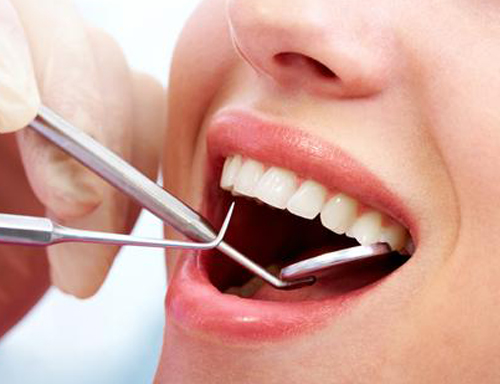 Dental Examination - Nick Dental