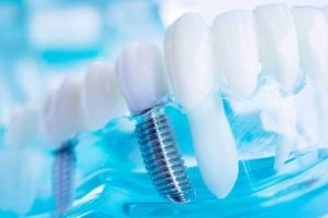 restorative dentistry 