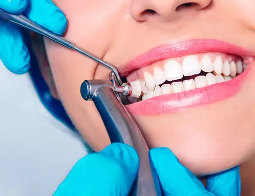 Professional dental cleaning and polishing procedure.